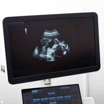 Cat Ultrasound